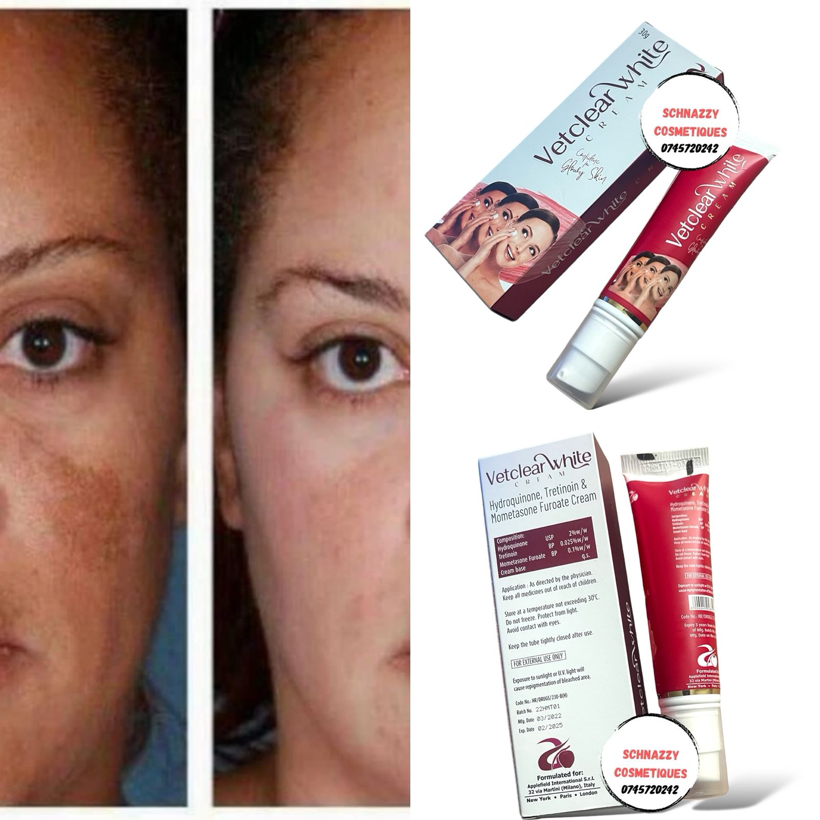 Tretinoin (Hydroquinone Mometasone) Hyperpigmentation Melasma Acne Dark Spots Scars Real Skin Soft & Beauty Clear Skin Coral's Golden Beauty Nitroskin Acnesol 10 days cream RDL RX3 RX2