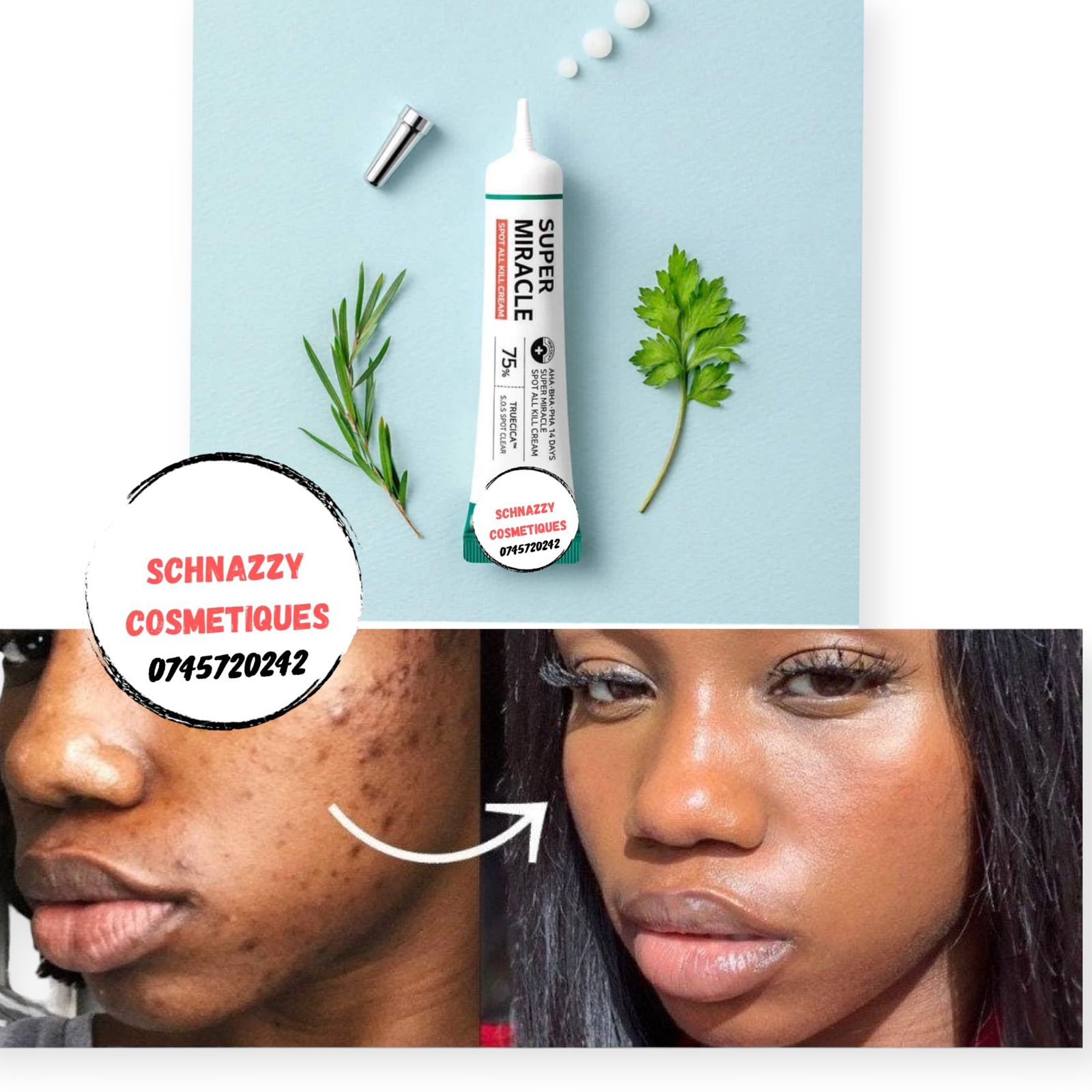 SUPER MIRACLE SPOT KILL CREAM Hypoallergenic Clear Spots AHA BHA PHA 14 Days Truecica S.O.S Spot Clear
