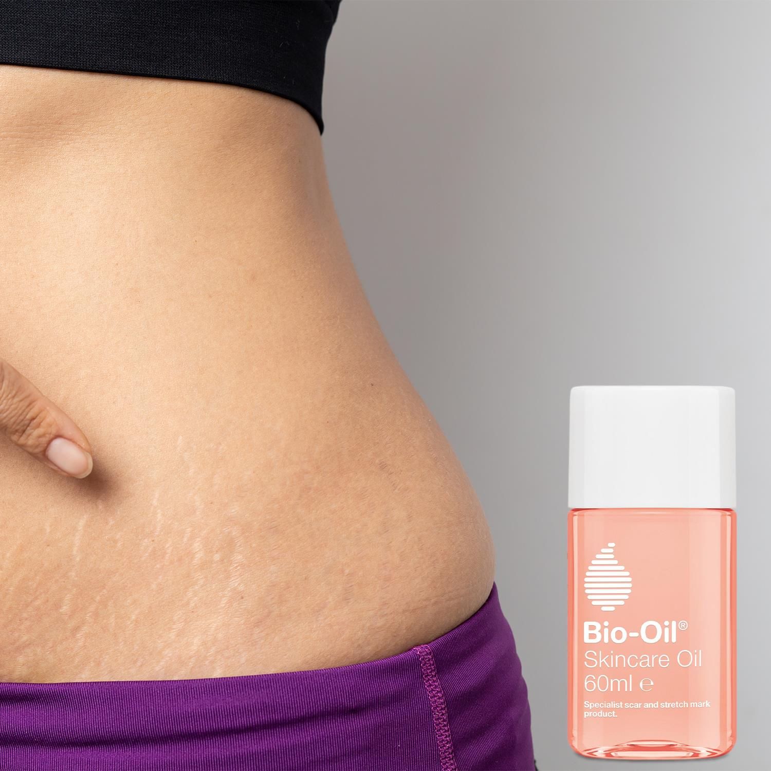 Bio Skincare Oil for Scars Stretchmarks Hyperpigmentation Moisturising Improve Appearance of Uneven Skin Tone Softer Smoother More Supple Faster Wound Healing New Arrivals Bio Oil