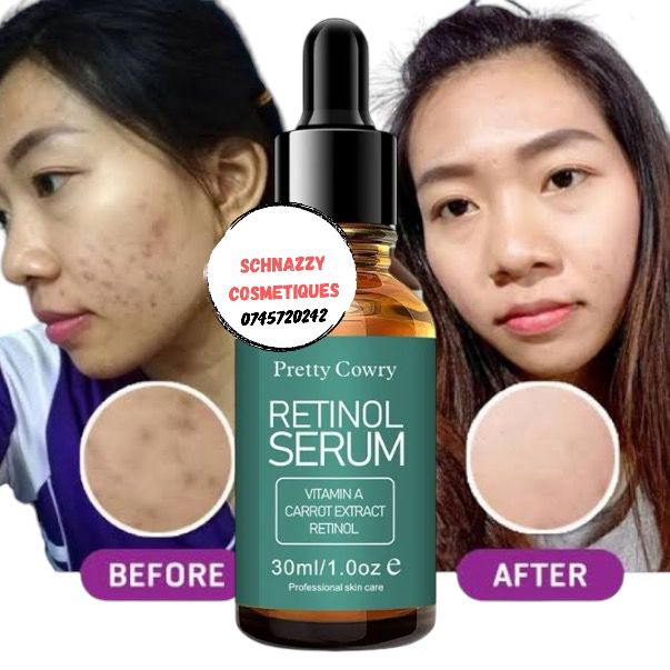 Pretty Cowry Retinol Serum with Vitamin A Carrot Extract Improves Skin Appearance Fade Dark Spots Clear Smoother Plump Skin Boost Collagen production Unclog Pores Tretinoin Retin A Serum