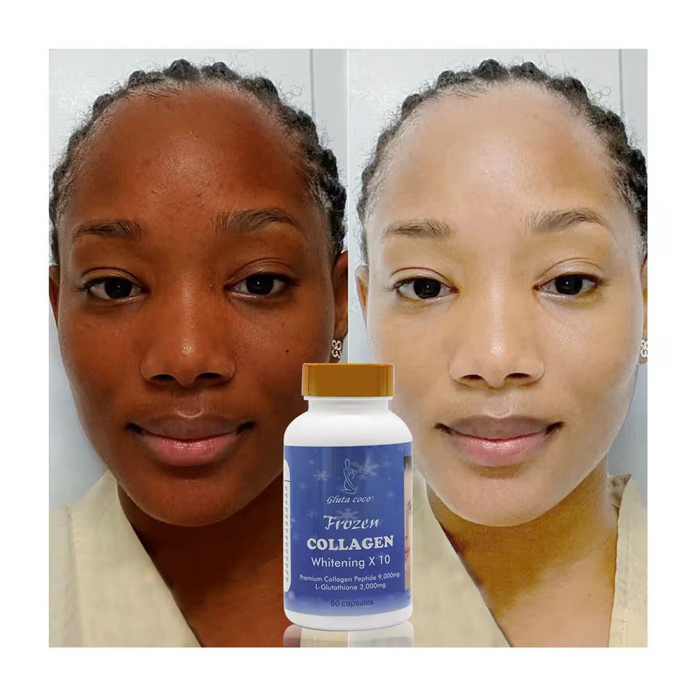 Frozen COLLAGEN Whitening Capsule X 10 Premium Collagen Peptide 9,000mg, L- Glutathione 3000mg.Collagen Whitening Capsule Repair Blemishes Acne-Acid With 3000 mg L-Glutathione