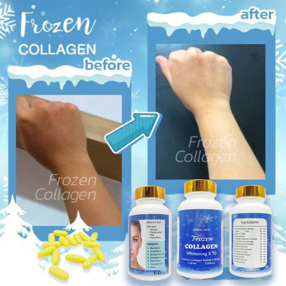 Frozen COLLAGEN Whitening Capsule X 10 Premium Collagen Peptide 9,000mg, L- Glutathione 3000mg.Collagen Whitening Capsule Repair Blemishes Acne-Acid With 3000 mg L-Glutathione