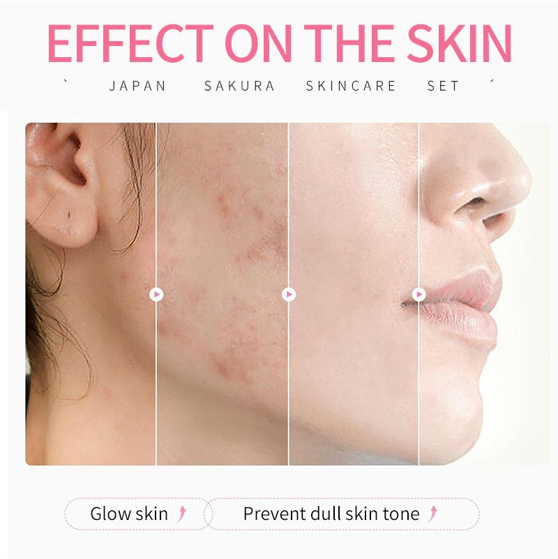 Sakura Kit Skin Care Sets Moisturizing and Reducing Fine Lines Cleansing Pore Product 5-Piece JAPAN Skincare Set Face cleanser- Face toner-Sakura serum -Facial cream - Eye cream  prefect gift