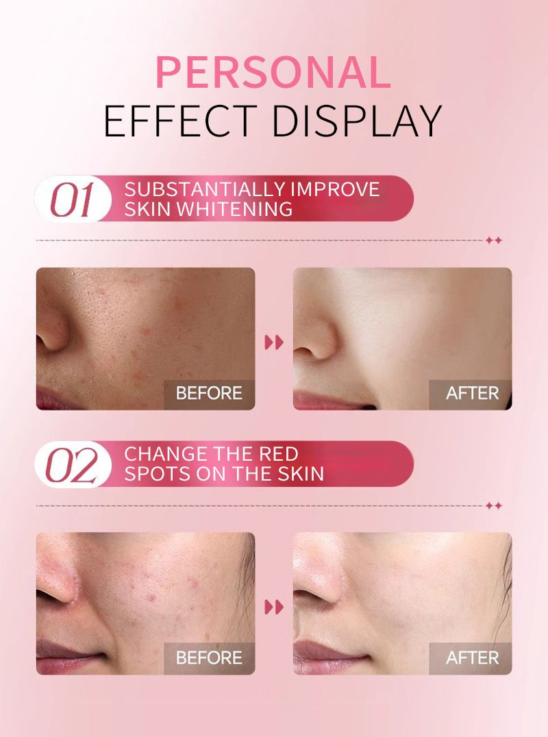 Sakura Kit Skin Care Sets Moisturizing and Reducing Fine Lines Cleansing Pore Product 5-Piece JAPAN Skincare Set Face cleanser- Face toner-Sakura serum -Facial cream - Eye cream  prefect gift