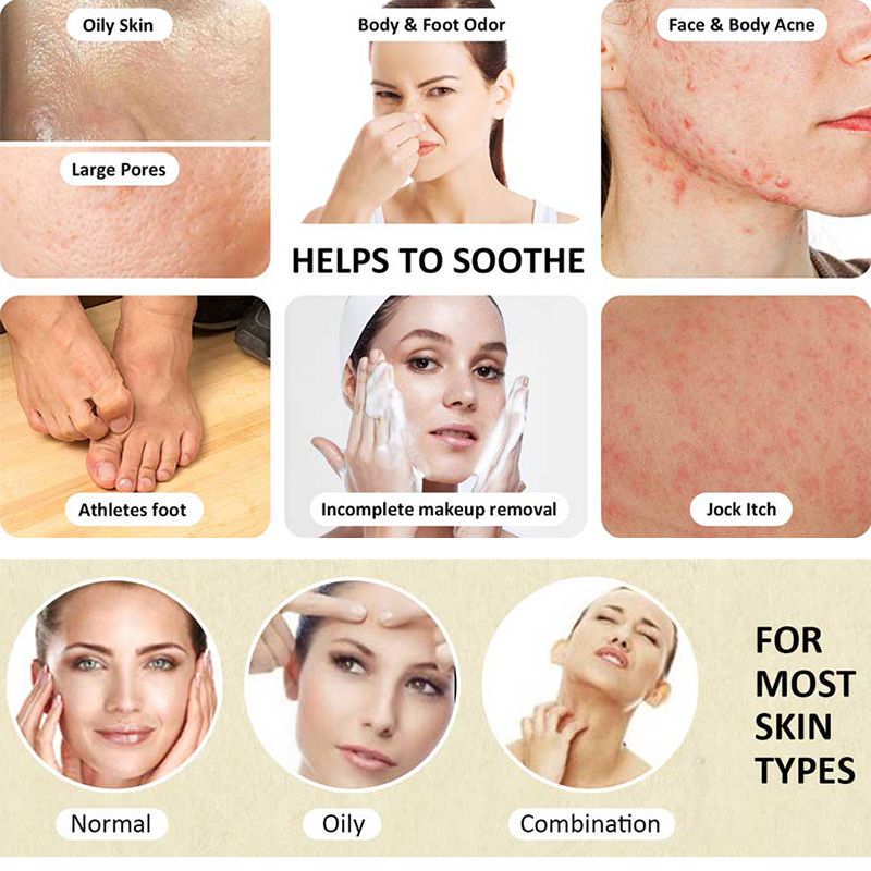 Shanghai Sulfur Soap Advanced Mite Removal Bath Whole Body Antibacterial and Mite Removal Soap | Face Soap | Back Acne Soap