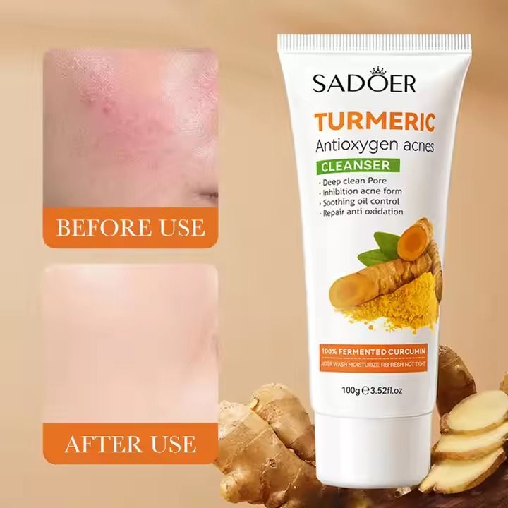 SADOER Turmeric Face Wash Deep Cleansing Remove Blackhead Acne Shrink Pores Facial Cleanser Oil Control Whitening Cleanser