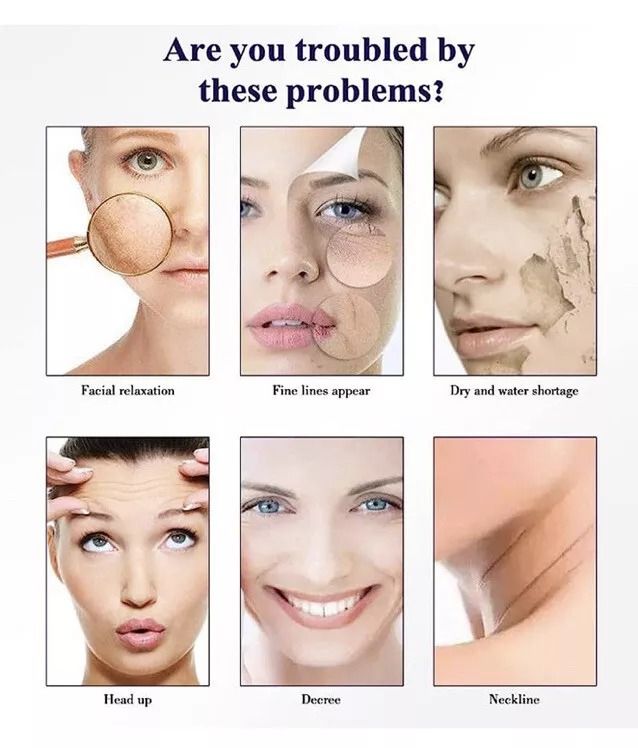2 Pieces SADOER Hyaluronic Acid Serum, Moisturizing Essence, Anti-Aging Serum for Fine Lines and Anti Wrinkles