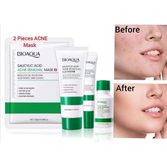 BIOAQUA 5 in 1 Skin care Set Pieces Acne Treatment Salicylic Acid Kit, 2 Pieces Face Mask + Face Cleanser +Salicylic Essence + Salicylic 20g Cream