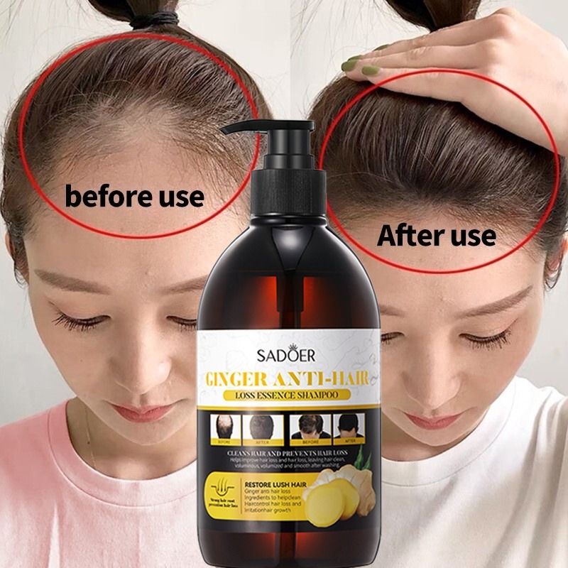 2 in 1 Hair Shampoo+Anti Hair Loss Essense SERUM Treatment Shampoo Essence, Hair Growth Ginger Extract Beard Growth,Hair Growth, Anti Dandruffs Hair Moisturizing Hair Care Shampoo, Derma Roller Compli