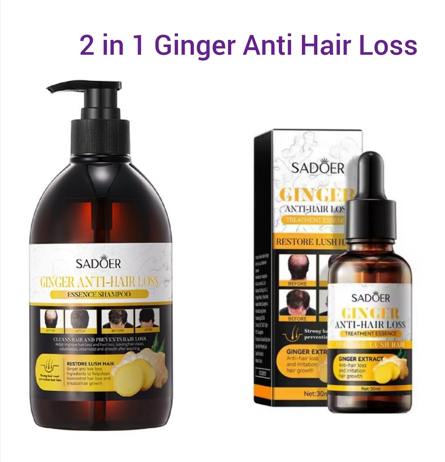 2 in 1 Hair Shampoo+Anti Hair Loss Essense SERUM Treatment Shampoo Essence, Hair Growth Ginger Extract Beard Growth,Hair Growth, Anti Dandruffs Hair Moisturizing Hair Care Shampoo, Derma Roller Compli