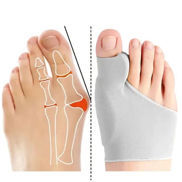 Toe separator hallux valgus bunion corrector foot pain relief orthopedic pedicure tools foot care dailyuse