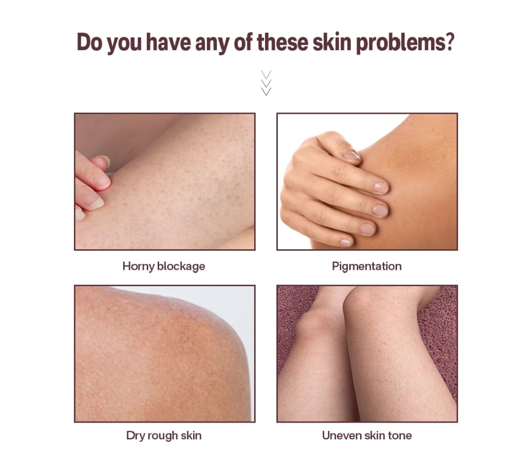 Exfoliating ,Moisturizing & Foaming Scrub (Face & Body)
For all skin types – gently removes dead skin, clears acne, and deeply hydrates for smooth, glowing skin.