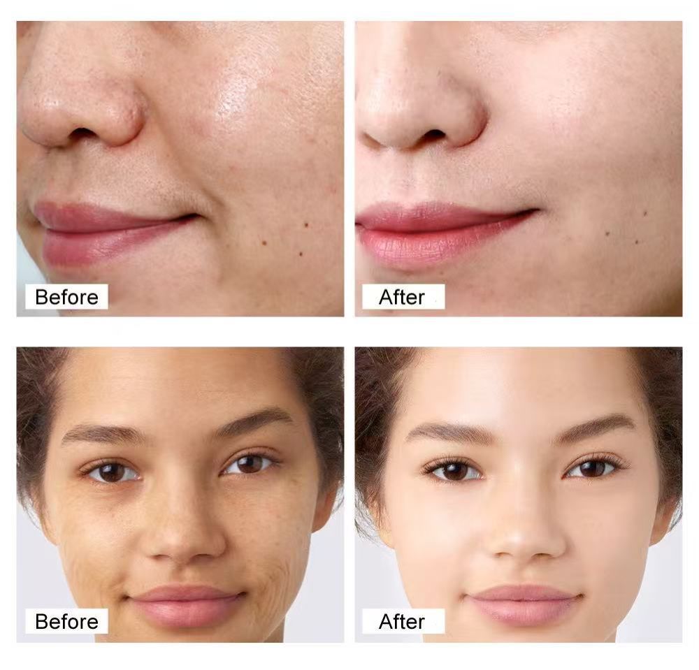 Retinol face cream reduces fine lines  firms and lifts  anti-wrinkle and reduces fine lines moisturizes and brightens skin  facial moisturizing essence cream  excellent skincare product