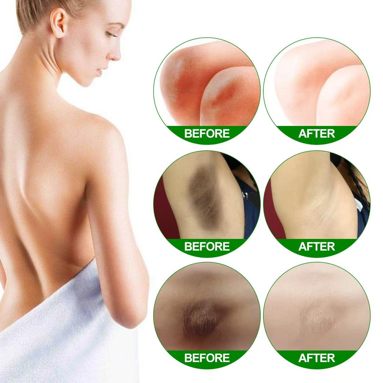 Body whitening cream  removes melanin  dark spots  improves dullness  nourishes and moisturizes the skin  brightens and softens the skin  private area whitening  skincare cream