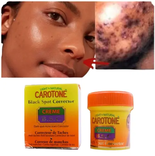 Carotone Black Spot Corrector Cream Clears Acne Scars & Dark spots