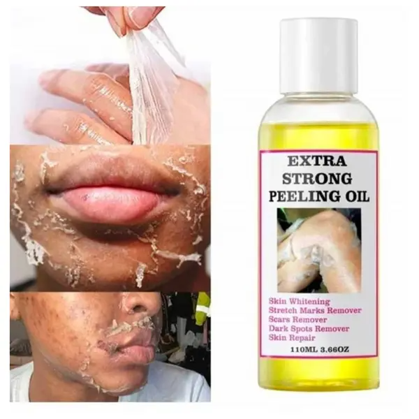 Extra Strong Peeling Oil Intensely Exfoliates, Reduces Dark Spots, Evens Tone, Improves Texture, Promotes Cell Turnover, And Enhances Product Absorption.