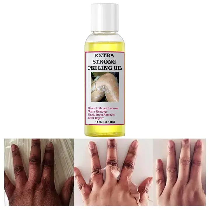 Extra Strong Peeling Oil Intensely Exfoliates, Reduces Dark Spots, Evens Tone, Improves Texture, Promotes Cell Turnover, And Enhances Product Absorption.