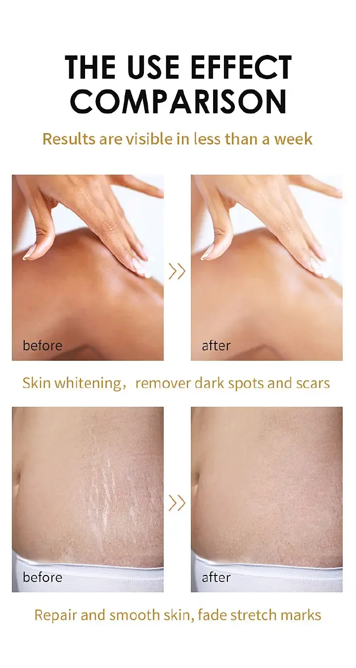 Extra Strong Peeling Oil Intensely Exfoliates, Reduces Dark Spots, Evens Tone, Improves Texture, Promotes Cell Turnover, And Enhances Product Absorption.
