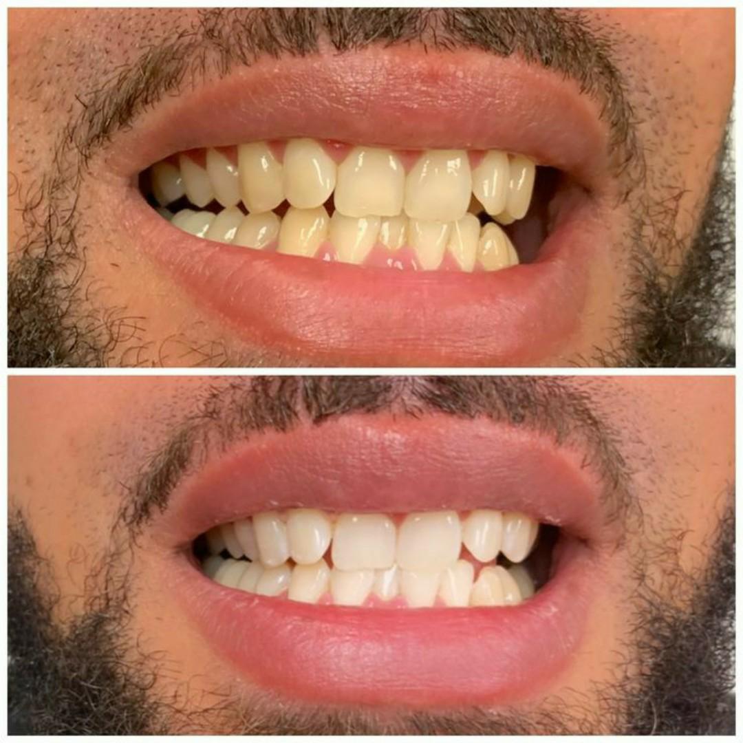 tooth savior powder