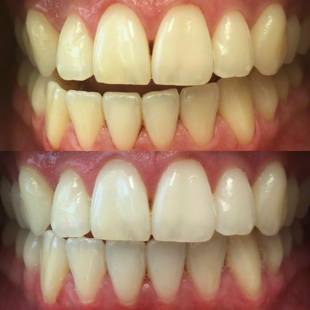 tooth savior powder