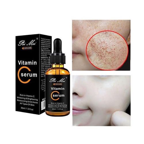 Pei Mei Whitening & Brightening Vitamin C Face Serum, 30ml