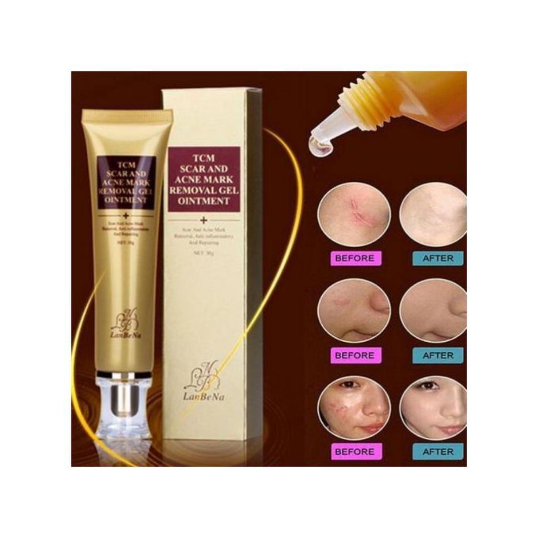 TCM Scar & Acne Mark Removal Gel Ointment--All-natural formula
Paraben free, no animal testing, no colorants