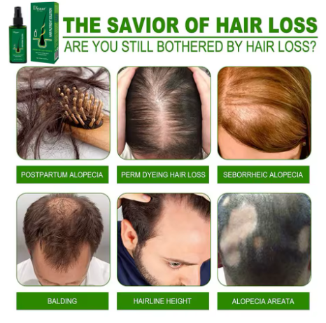 Disaar Hair Care Essential Hair Oil Anti-hair loss 120ml Promotes hair growth Hair Regrowth Treatment Essential Oil. Nourish, strengthen, and restore your hair’s natural shine with Disaar