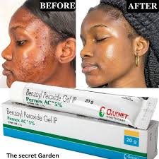 OAKNET Benzoyl Peroxide Gel With Pernex AC 5% 20g