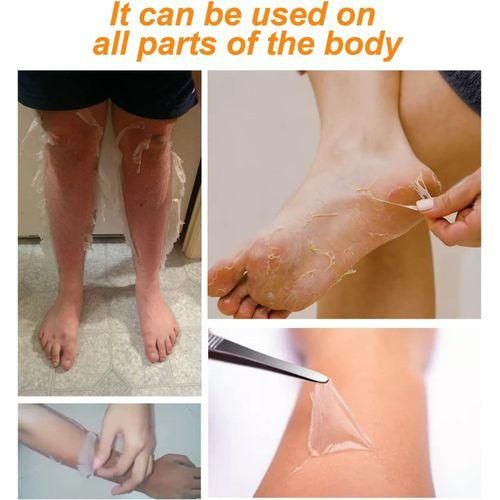 O'Carly Body Whitening Peeling Lotion. Brightens, Moisturizing, Exfoliates, Smooths, Remove Dark Spots, Dullness, Firms, Tighten pores & remove dirt, dust and unwanted Skin