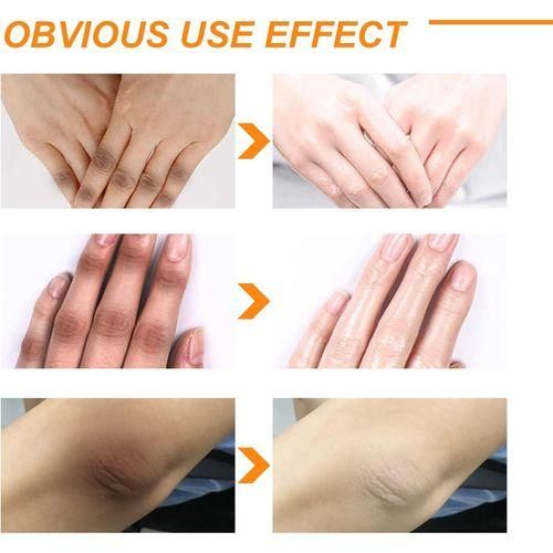 O'Carly Body Whitening Peeling Lotion. Brightens, Moisturizing, Exfoliates, Smooths, Remove Dark Spots, Dullness, Firms, Tighten pores & remove dirt, dust and unwanted Skin