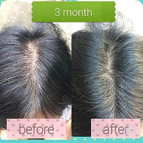 Neo 3-Pack Hair Lotion 120ml Hair Treatment Hair Root Nutrients