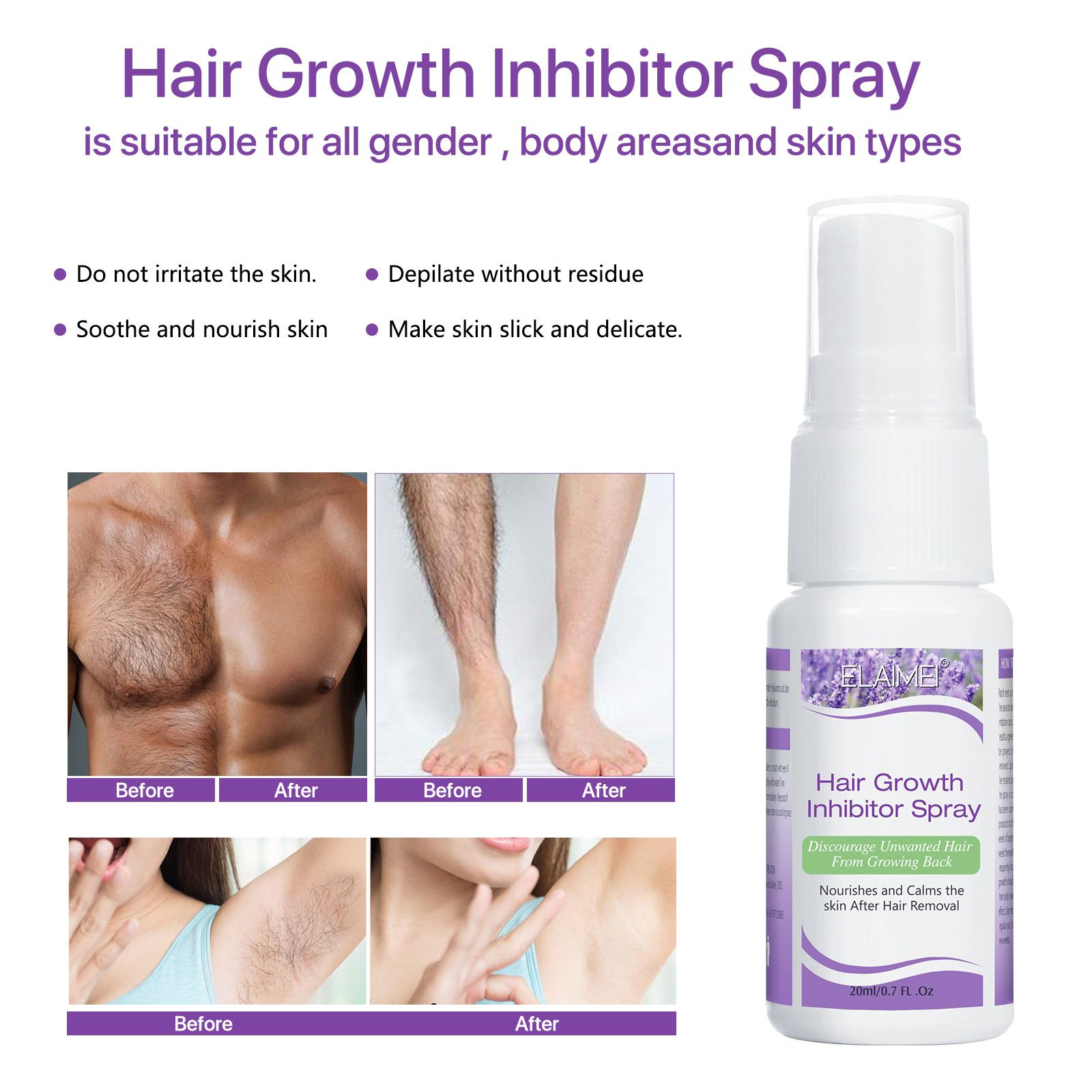 Permanant Hair Growth Removal Inhibitor Spray Beard Bikini Intimate Legs Body Armpit Painless Facial Stop Hair Depilatory 20ml