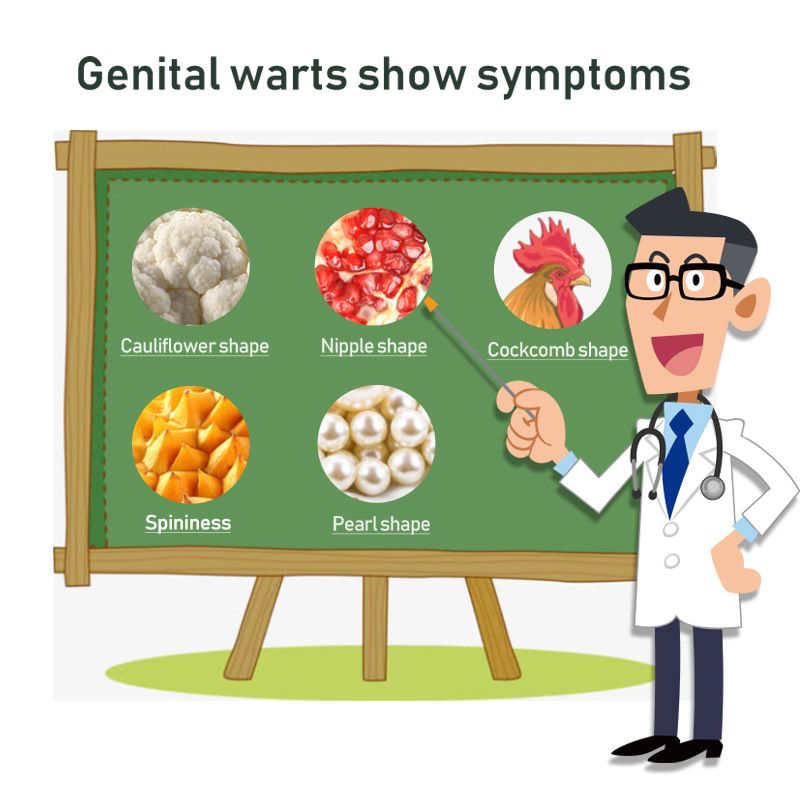 20g Genital Wart Herpes Remover Ointment Skin Tags Mole &amp; Papillomas Wart Remover Condyloma Acuminatum Treatment Cream