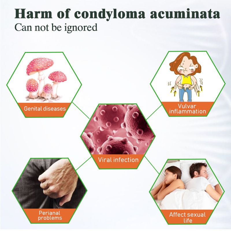 20g Genital Wart Herpes Remover Ointment Skin Tags Mole &amp; Papillomas Wart Remover Condyloma Acuminatum Treatment Cream