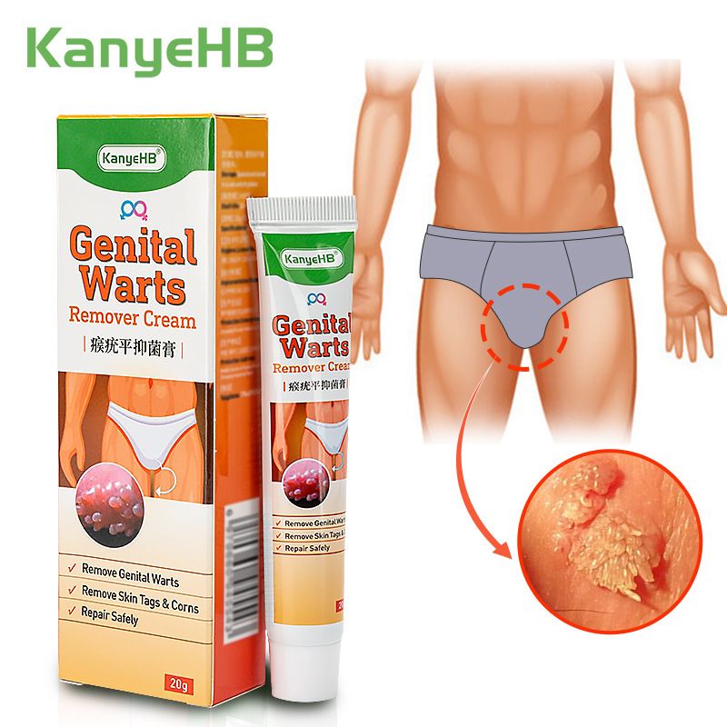 20g Genital Wart Herpes Remover Ointment Skin Tags Mole &amp; Papillomas Wart Remover Condyloma Acuminatum Treatment Cream