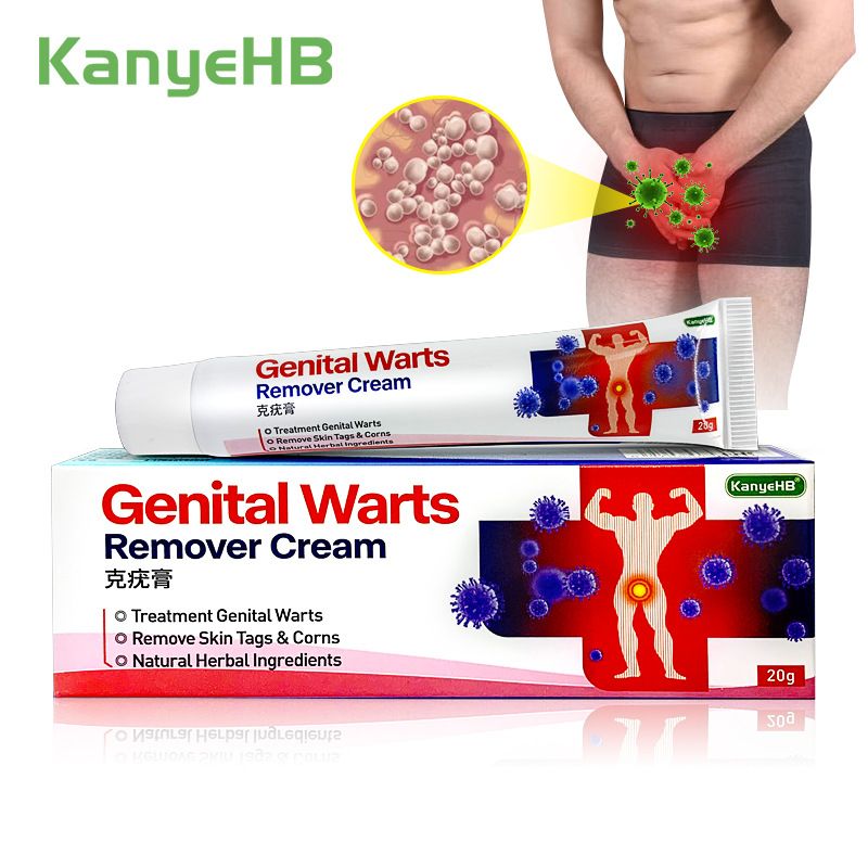 Anal Condyloma Cream 20g Treatment Genital Wart Ointment Vulva Herpes Condyloma Acuminatum Skin Tag Painless Remover
