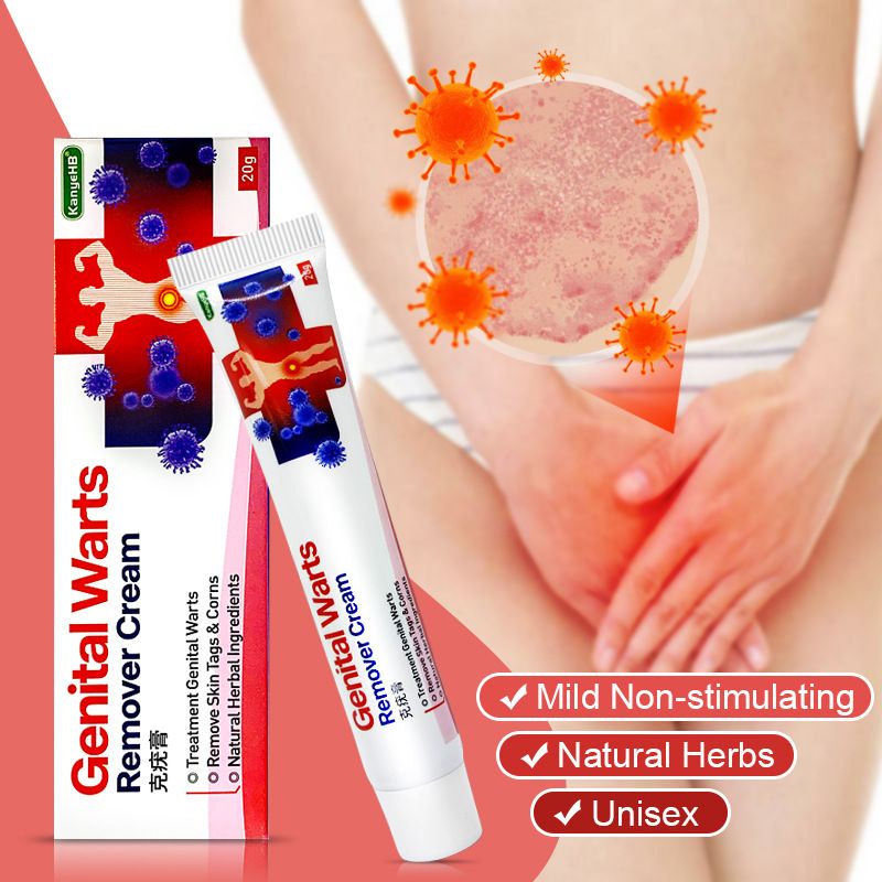 Anal Condyloma Cream 20g Treatment Genital Wart Ointment Vulva Herpes Condyloma Acuminatum Skin Tag Painless Remover