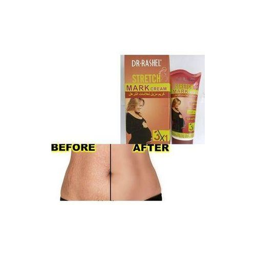 DR RASHEL Stretchmark Removal Cream