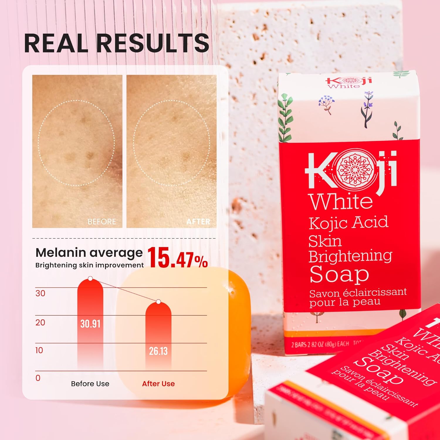 Koji White Pure Kojic Acid Skin Brightening Soap 160g