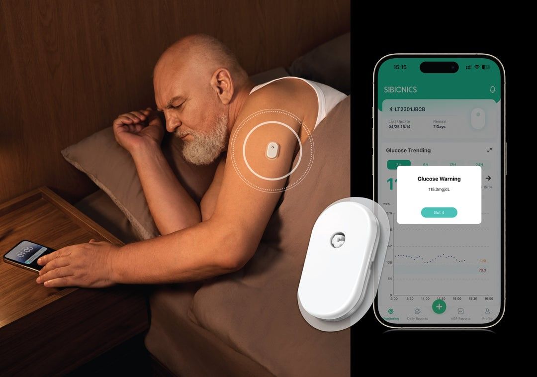 SIBIONICS GS1 CONTINUOUS GLUCOSE MONITOR