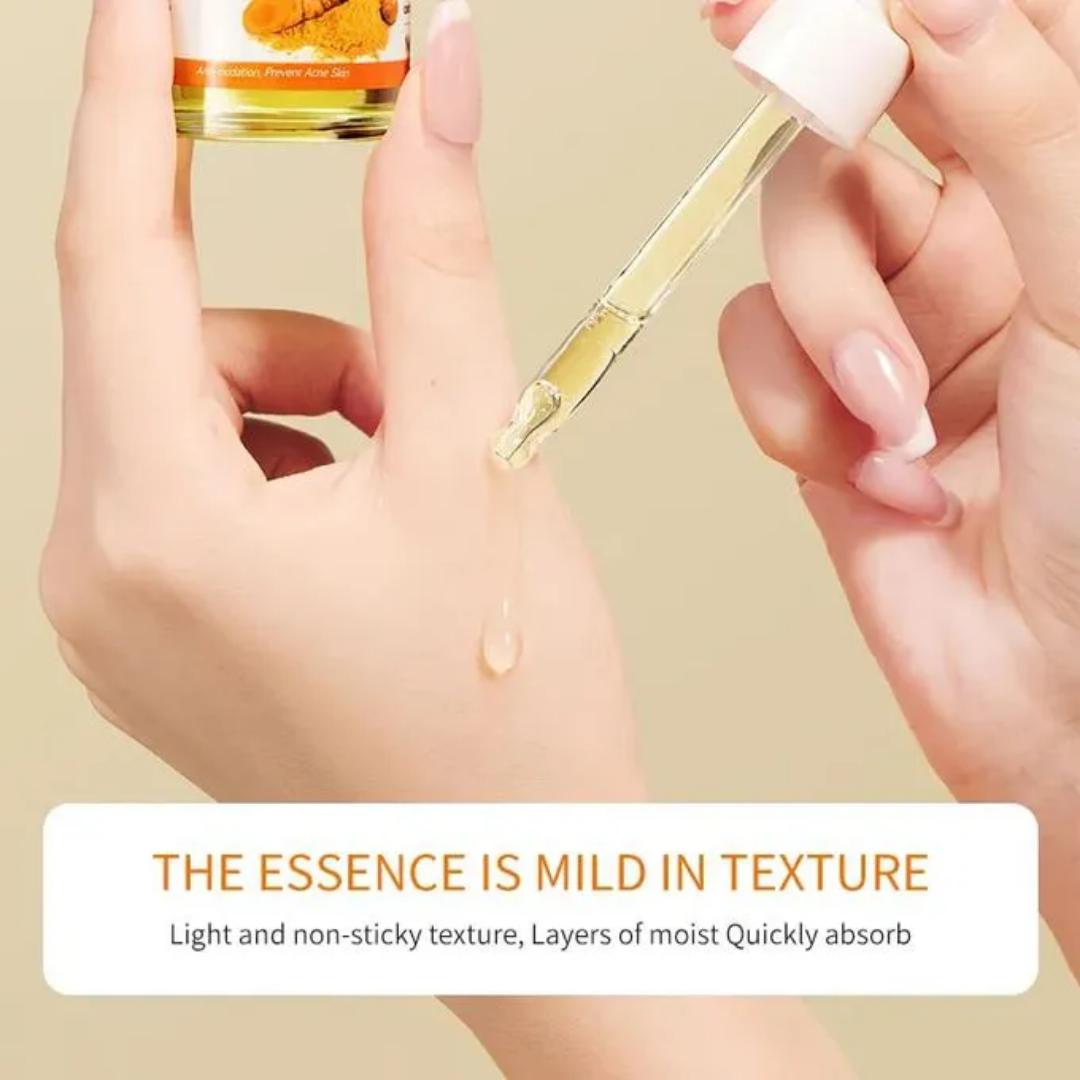 5 in 1 Sadoer Turmeric Set, Tumeric Cleanser + Face Serum +Face Toner + Face Cream + Tumeric Soap, with unparelled Vitamin C capabilities, Helps in Preven Acne, Sooth, Hydrate, Lighjten Acne Marks