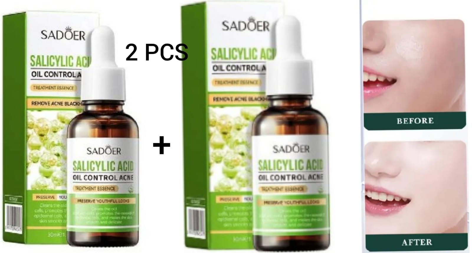 2 Pieces Sadoer Salicylic Acid Serum for Face  Shrink Pores, Gentle Exfoliating, Salicylic Acid for Anti Acne, Pimple, Spot, Blackhead Salicylic Acid Acne Treatment Essence_30ml