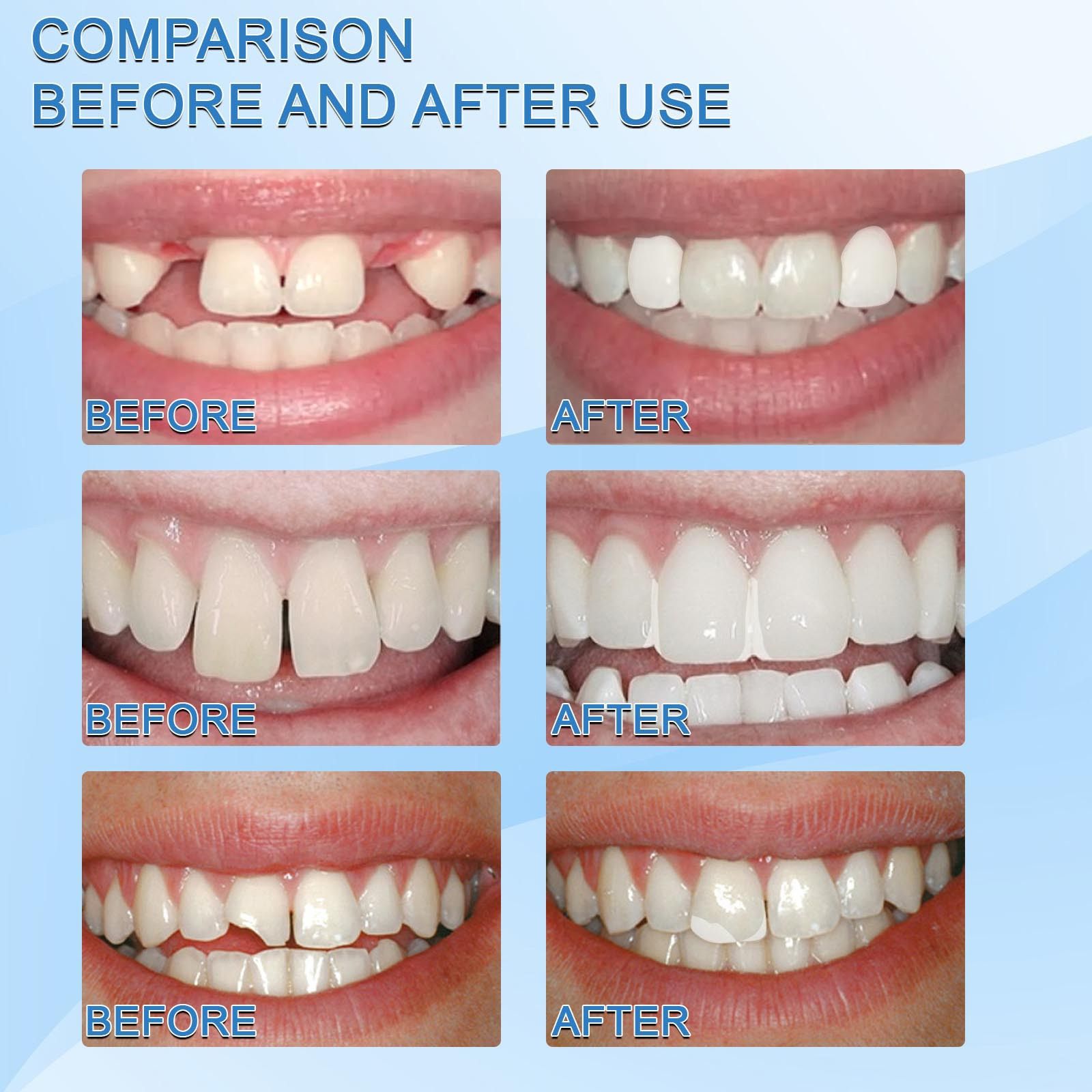 30ml Resin Temporary Tooth Repair Granules Teeth Gaps Missing Broken Tooth False Teeth Filling Moldable Solid Glue Dental Care