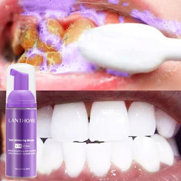 50ml Teeth Whitening Mousse Deep Cleaning Cigarette Stains Repair Bright Neutralizes Yellow Tones Dental Plaque Fresh Breath