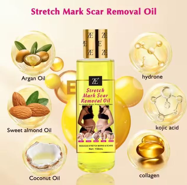 Quality Body Stretch Marks Oil Pregnant Scar effective Repair Remover Argan oil Vitamin C Stretch Marks Scar Removal Oil