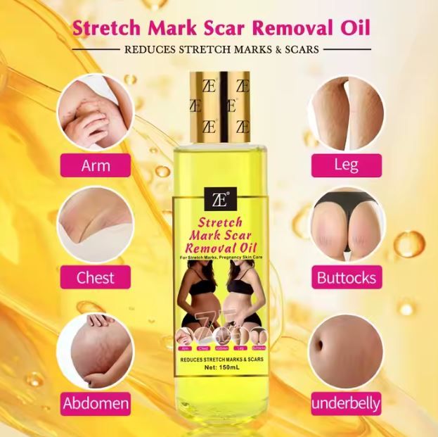 Quality Body Stretch Marks Oil Pregnant Scar removal effective Repair Remover Argan oil Vitamin C Stretch Marks Scar Removal Oil