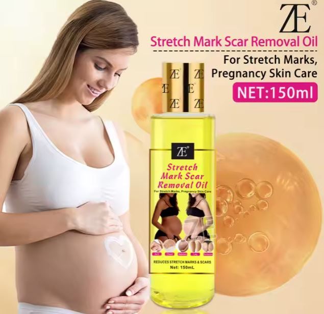 Quality Body Stretch Marks Oil Pregnant Scar removal effective Repair Remover Argan oil Vitamin C Stretch Marks Scar Removal Oil