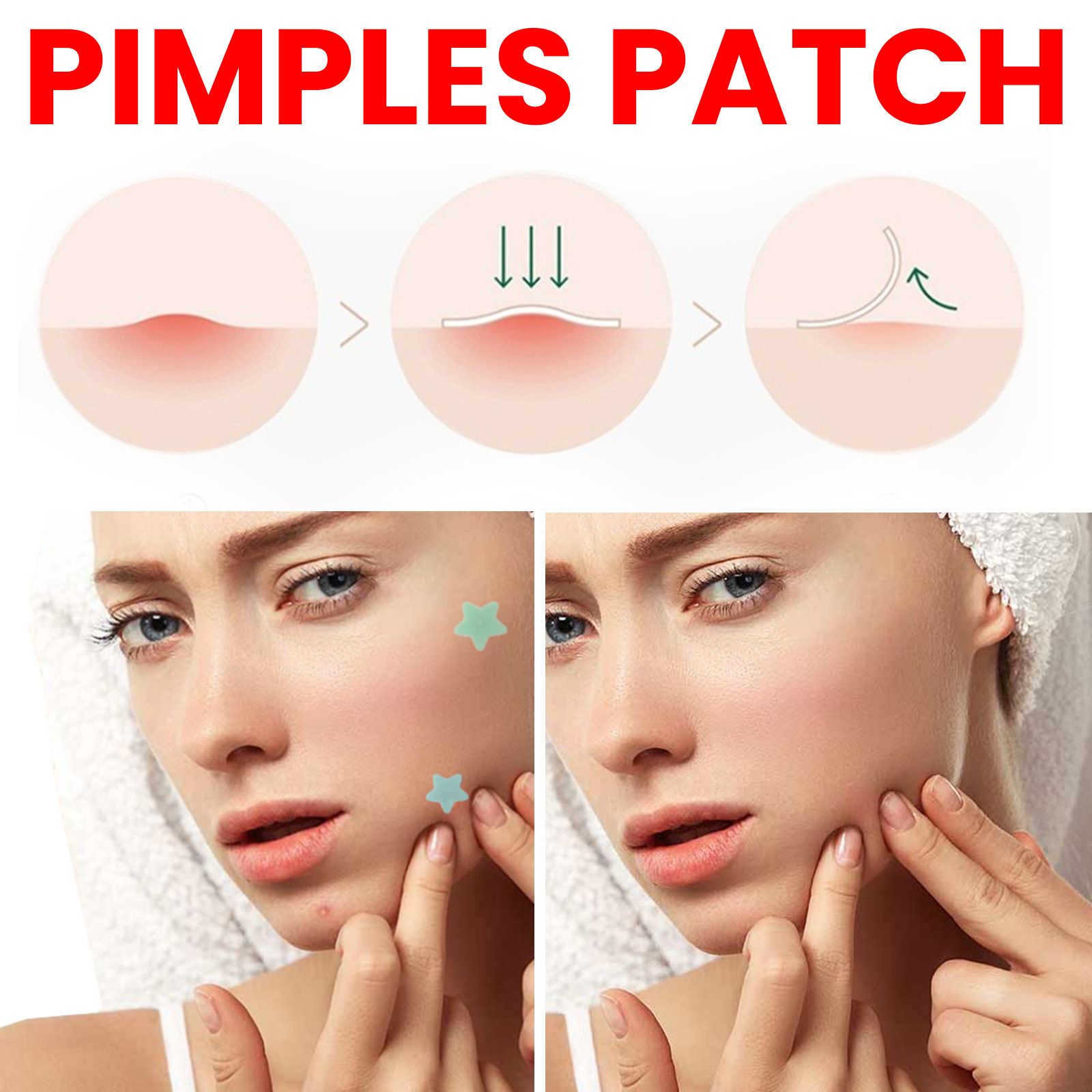 Star Pimple Patches for Face w/Hydrocolloid, Salicylic Acid & Tea Tree | 40 Patches | Hydrocolloid Acne Patches, Cute Star Pimple Patches for Healing Stickers Zit Patch Superstar