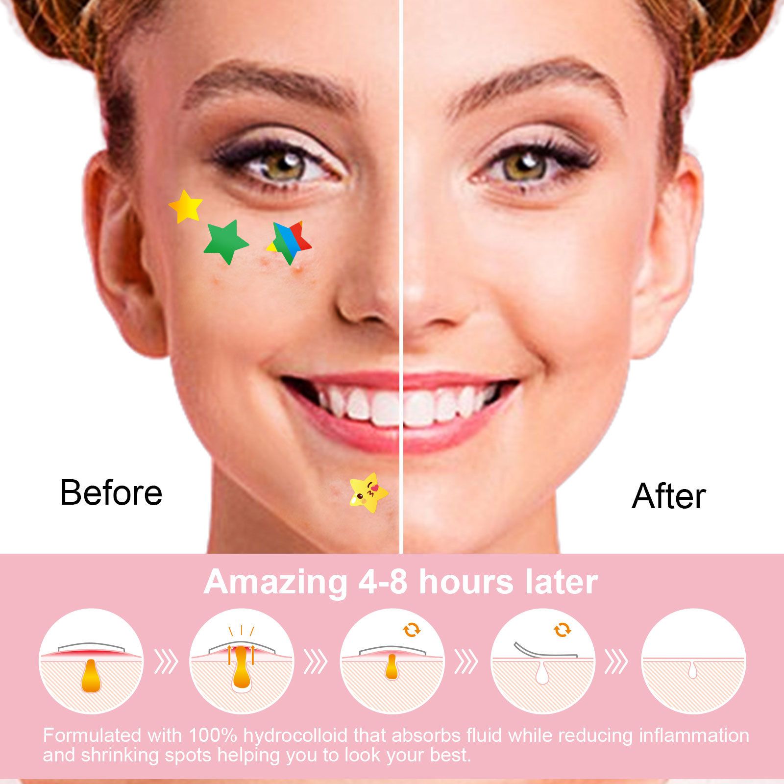 Acne Patch Pimple Patch 36Patches colourful emoji stars Acne Absorbing Cover Patch Hydrocolloid Invisible Acne Patches For Face Zit Patch Acne Dots Tea Tree Calendula Oil