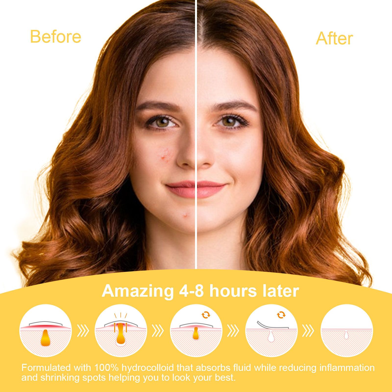 Pimple Patches for Face Day and Night Acne Patches emoji faces 30Patches Cute Spot Stickers with Tea Tree & Centella Oil, Strong Adhesion Zit Covers | 196 C